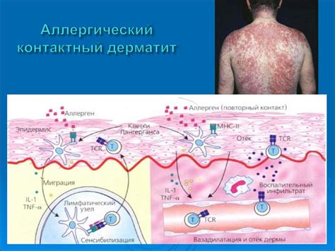 Внешние факторы и аллергические реакции