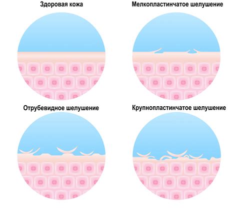 Возможные причины шелушения