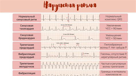 Нарушение природного ритма