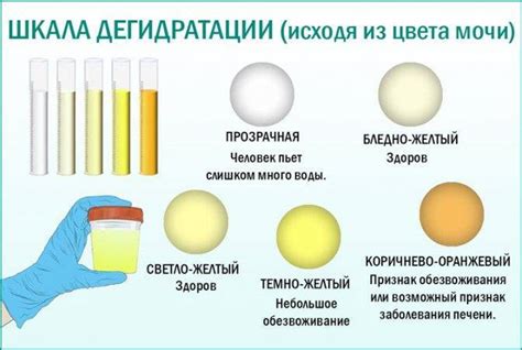 Оранжевый цвет мочи у новорожденных: причины и симптомы