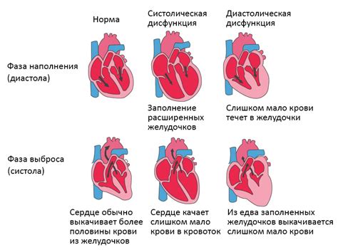 Острая кардиореспираторная недостаточность