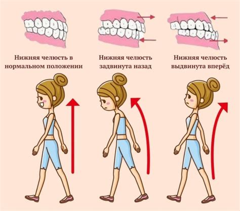 Постуральные проблемы и несовершенная осанка