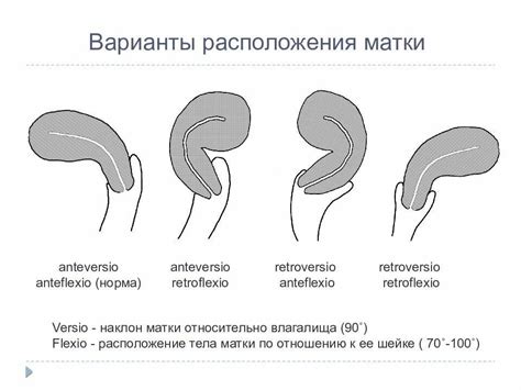 Реакция на положение матки