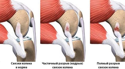 Травмы и повреждения суставов