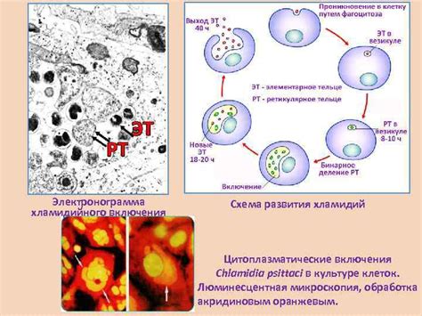 Урогенитальные инфекции